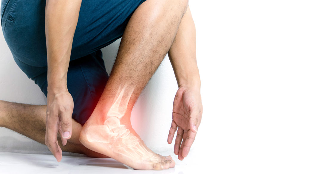 Fascitis plantar