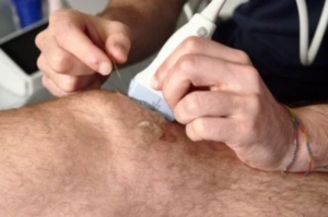 Fisioterapia EPI Clínica Alhóndiga