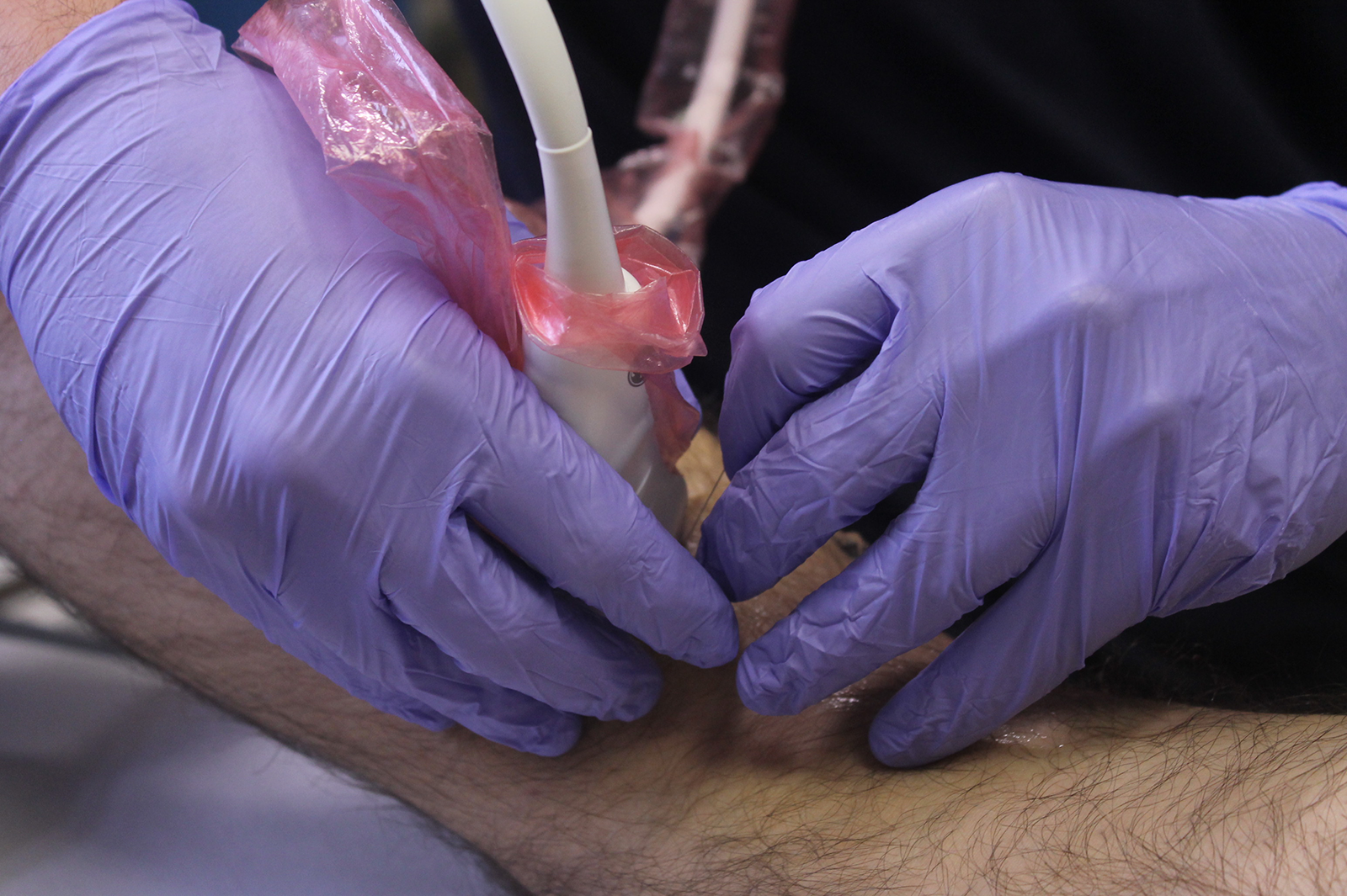 fisioterapia bilbao