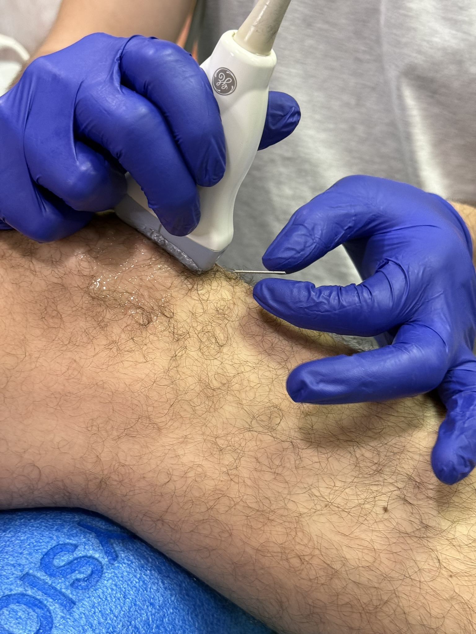 Fisioterapia EPI en Clínica Alhóndiga